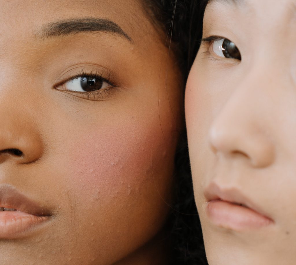How to Prevent Breakouts
